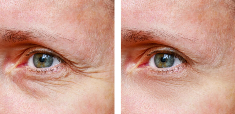 Aging Gracefully