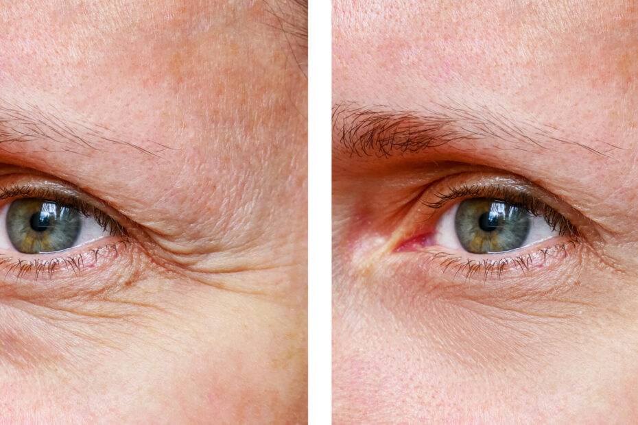 Aging Gracefully