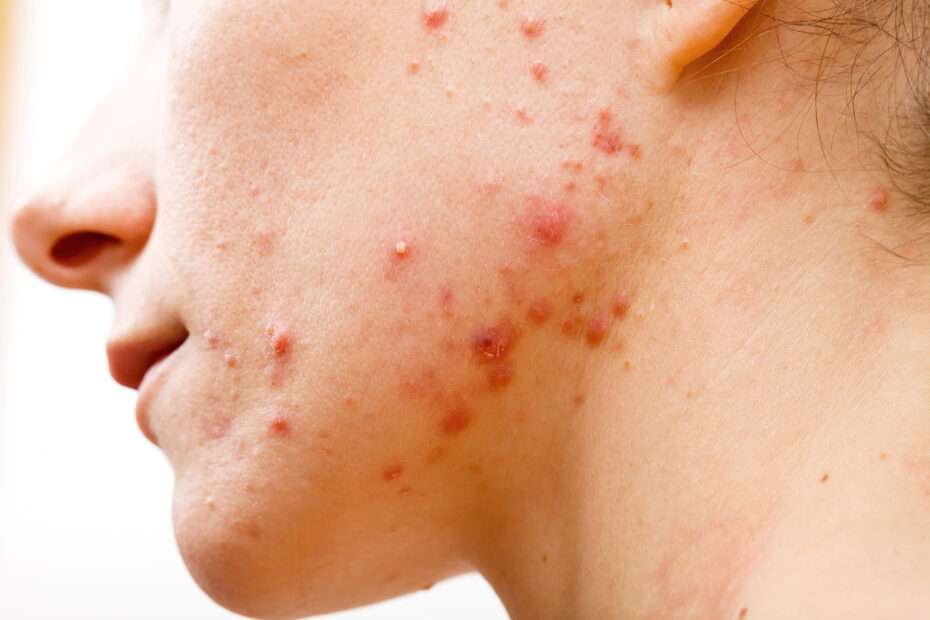 Skin Care Habits