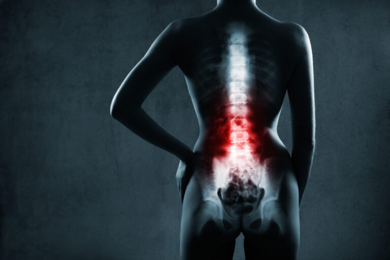 Relief for Everyday Back Pain