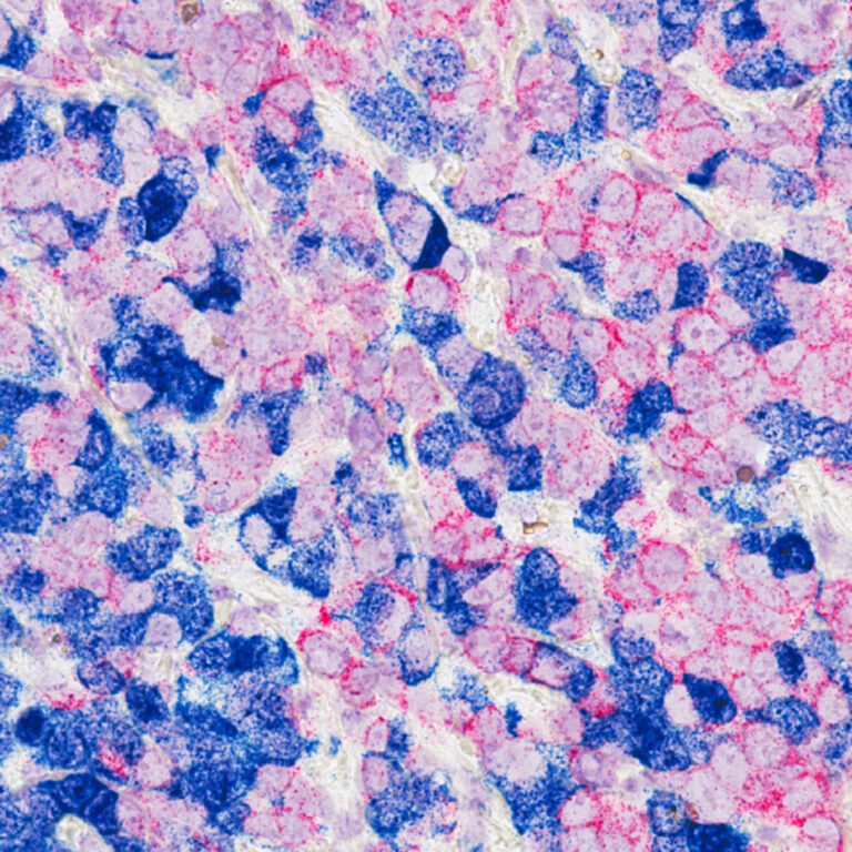 Healing with Breast Cancer