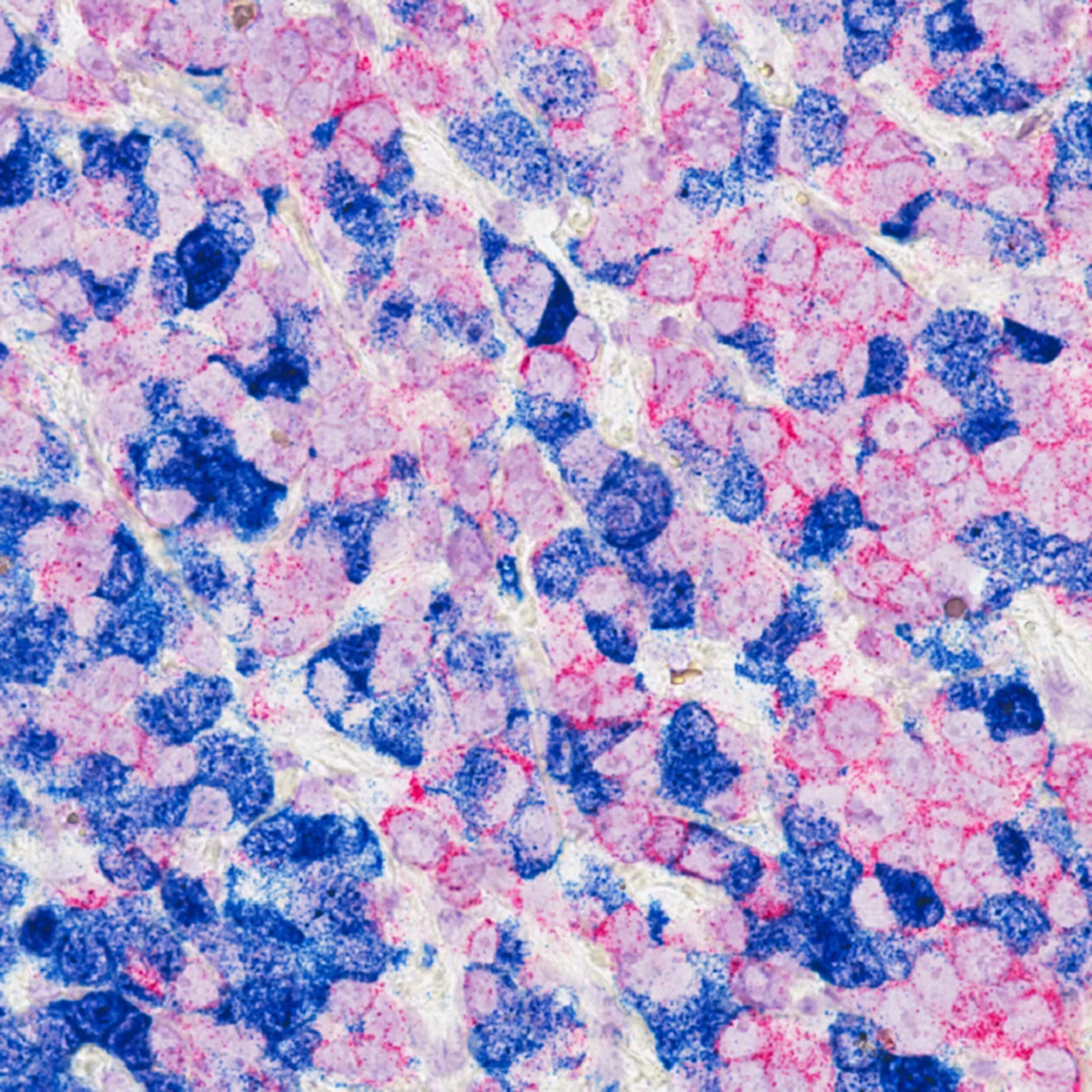 Healing with Breast Cancer